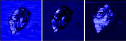 acoustic microscope로 액상에서 측정된 간세포의 초점 거리에 따른 이미지