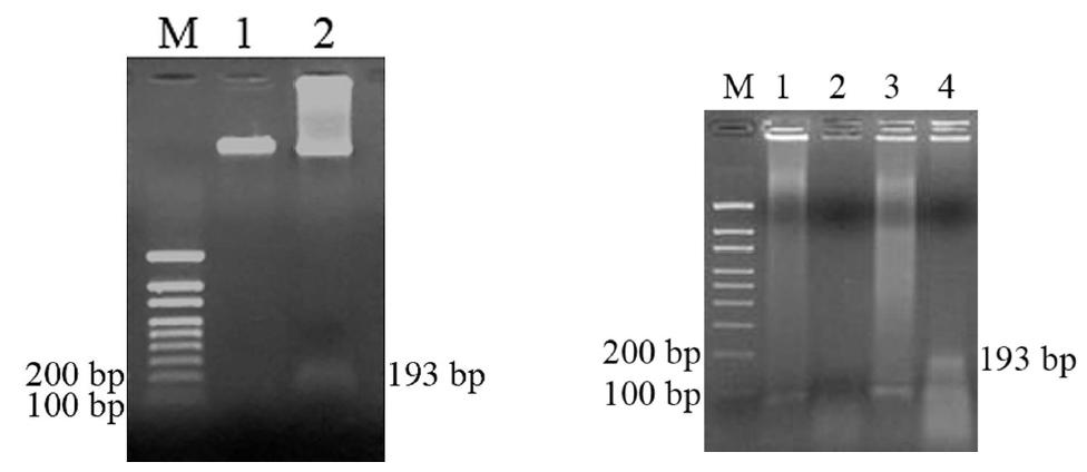 PCR 장비를 이용하여 증폭한 후 SMAD4 gene 검출 결과 (좌) 세포 분해 후 세포 찌꺼기를 거르지 않고 바로 증폭한 결과 (우)