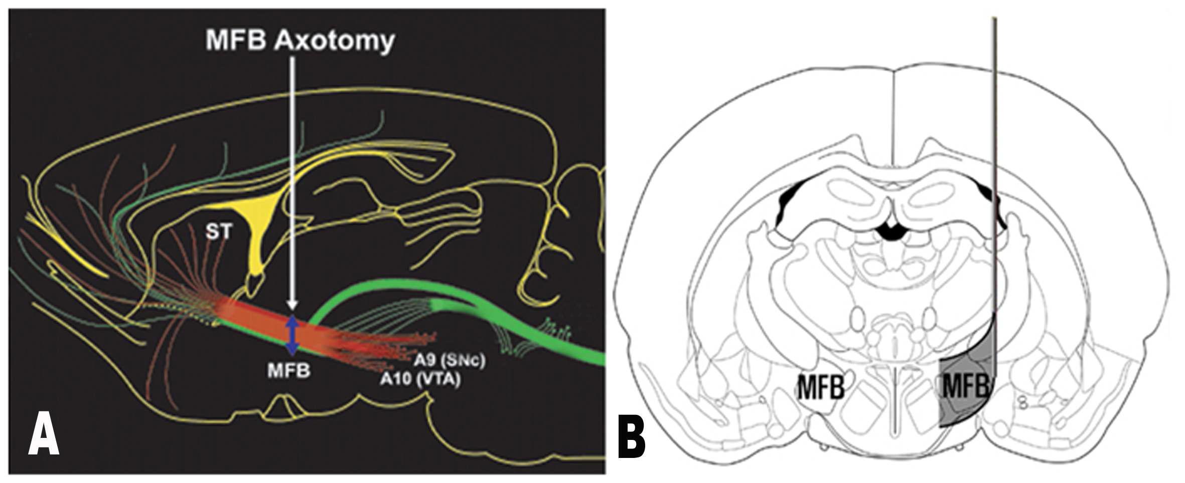 Sagittal (A) and coronal (B) view of the adult rat brain illustrating how the medial forebrain bundle (MFB) transection is conducted.