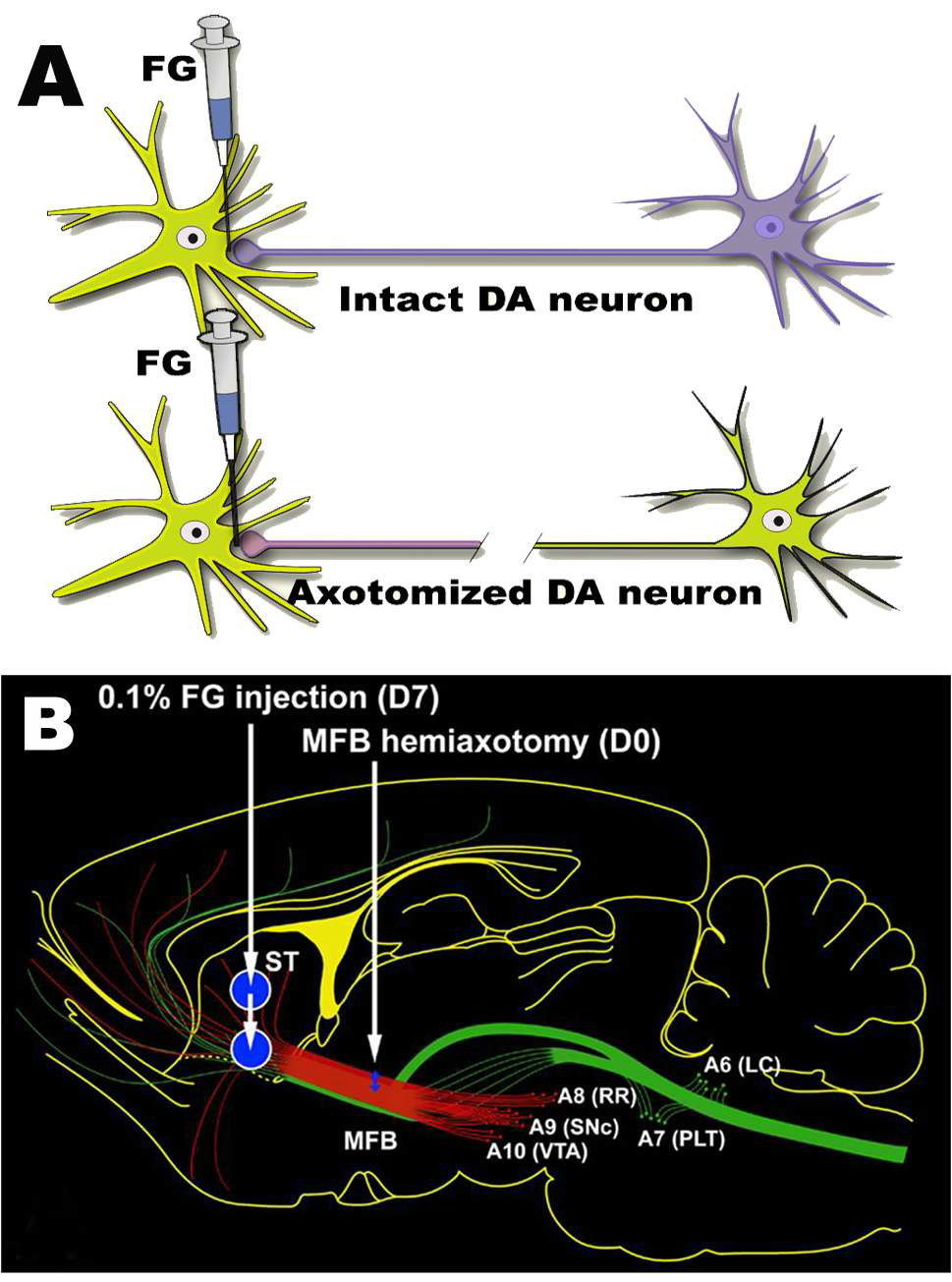 The graphical illustration which demonstrate the MFB hemi-axotomy methodand Fluorogold(FG) injection into the striatum.