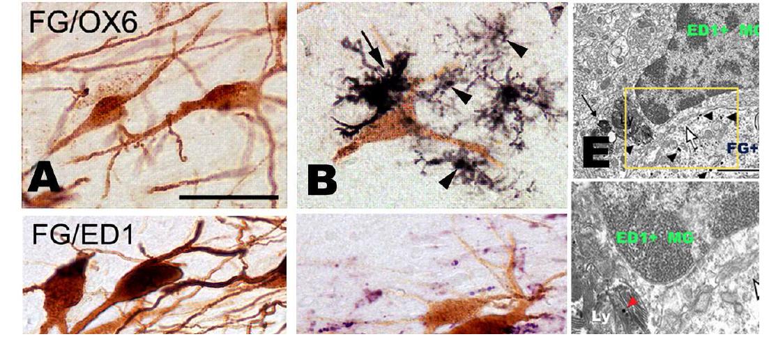 (A)-(D) are photographs of double immunolabeling of OX6 (C and D) or ED1 (E and F) with FG in the contralateral (A and C) and ipsilateral SN (B and D) at 14 days post MFB hemi-axotomy and FG injection. Note that OX6 positive microglia and their phagocytic activities were superimposed on the soma (arrows) and processes (arrowheads) of the FG-ir unaxotomied intact neurons.(E) and (F) are immuno-EM result demonstrating that activated microglia are closely attached to the FG-positive bystander neuron. Scale bar = 50 ㎛.