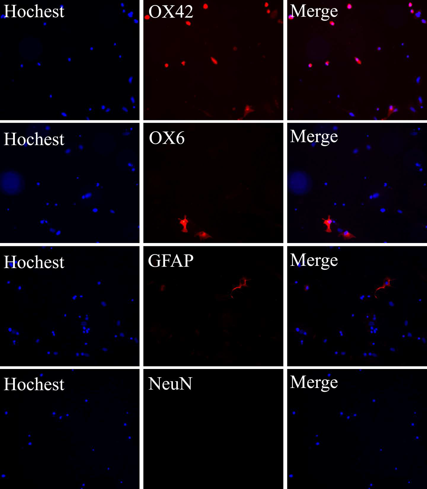 Immunocytochemistry of OX42, OX6, GFAP, and NeuN against primary cultured microglia.