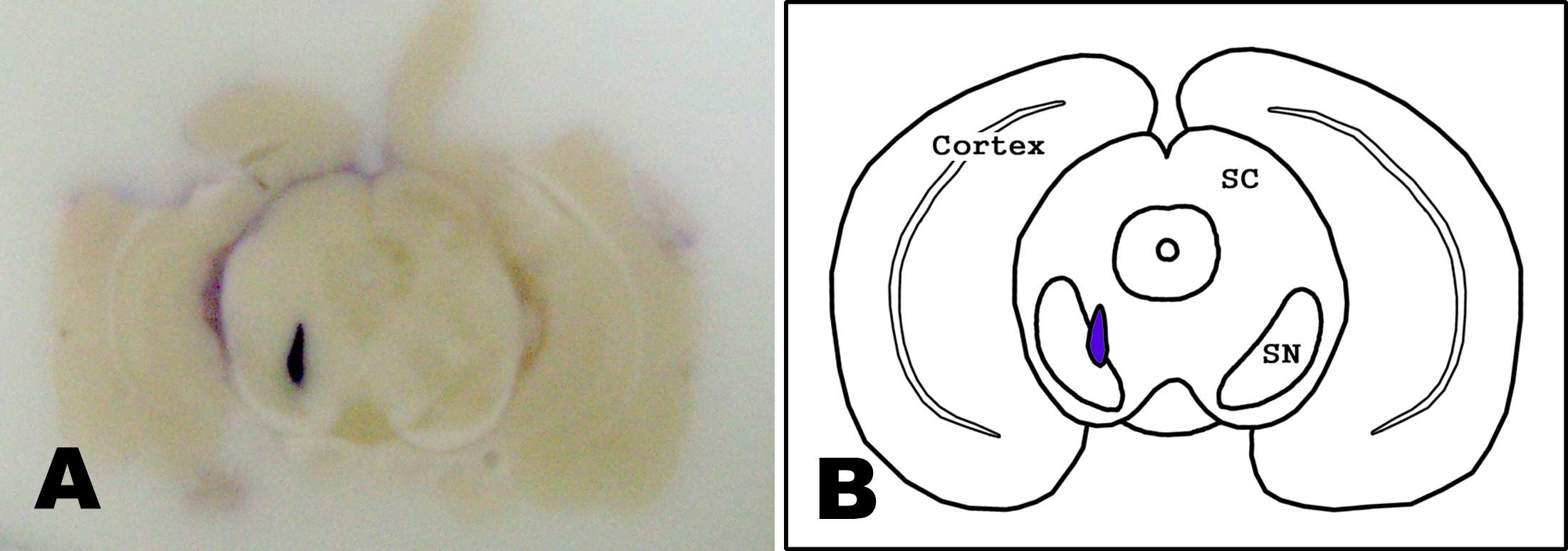 (A) Photograph of haetoxyline injection into the substantianigra (SN) and (B) the schematic diagram.