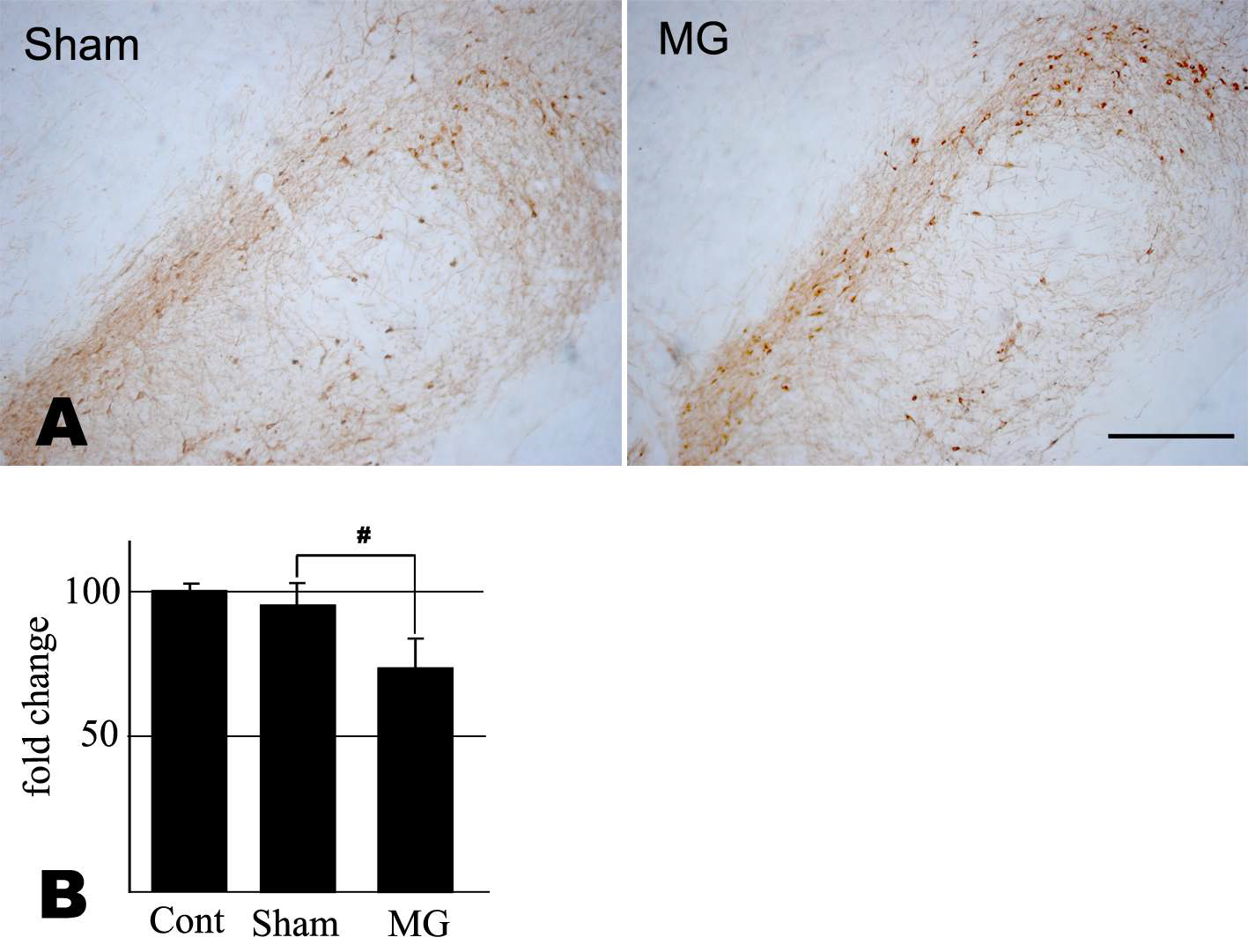 (A) TH immunohistochemistry in the ipsilateral substantia nigra at 14 days after vehicle (Sham) or activated microglia (MG) implantation. Scale bar represent 300 um. (B) Changes in the number of TH immunoreactive neurons in the ipsilateral vehicle or activated microglia implanted SN compared with contralateral SN.