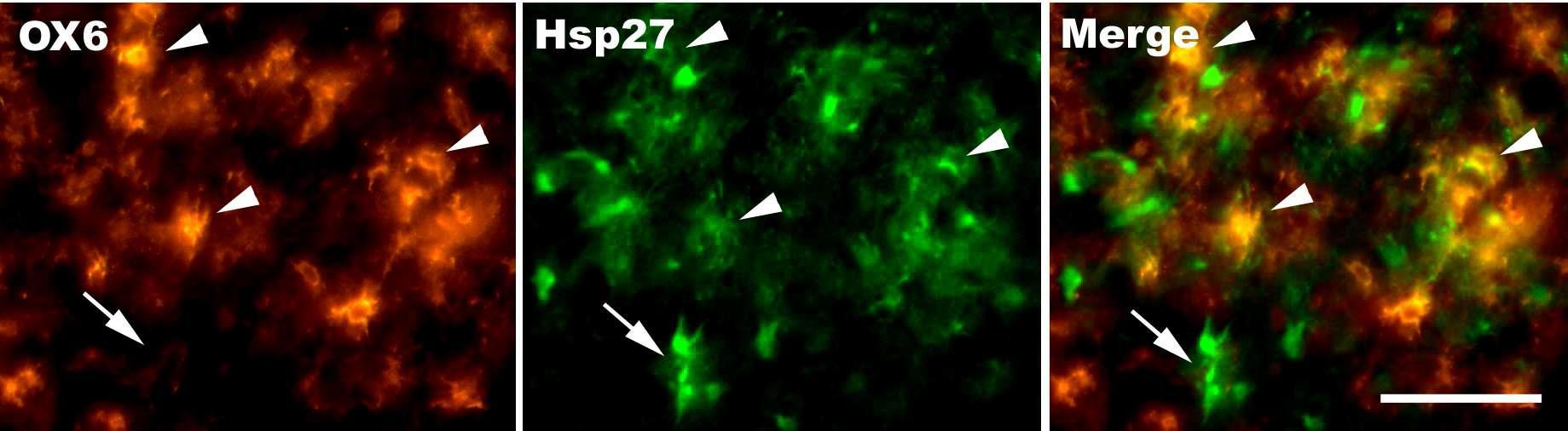 Double immunofluorescence of OX6 and Hsp27 and their merged image. Scal bar represents 30 um.