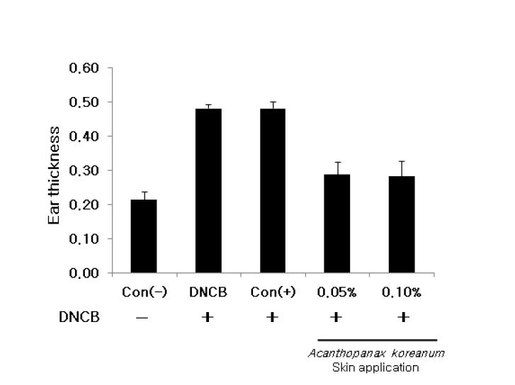 Effect of Acanthopanax koreanum on DNCB-induced ear thickness in BALB/c mice.
