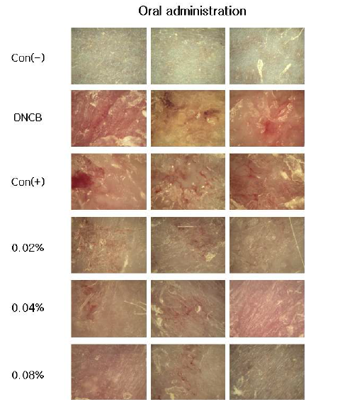 Clinical skin features of back skin by DNCB-induced allergic contact dermatitis BALB/c mice