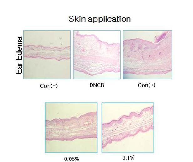 Ear edema of Balb/c mice. Protective Effects of Acanthopanax Koreanum on the DNCB-induced contact dermatitis in Balb/c Mice - histological evaluation using H&E stain.