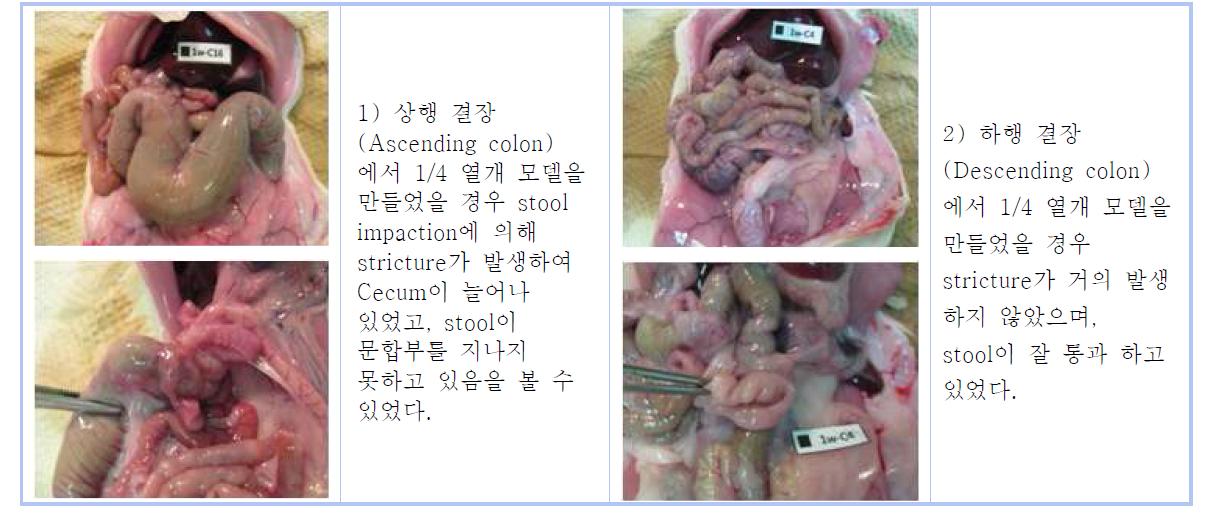 Stricture of colonic anastomosis in rat