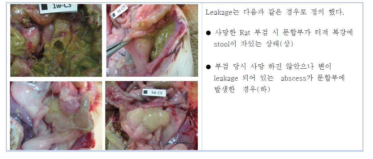 Anastomotic leakage의 정의