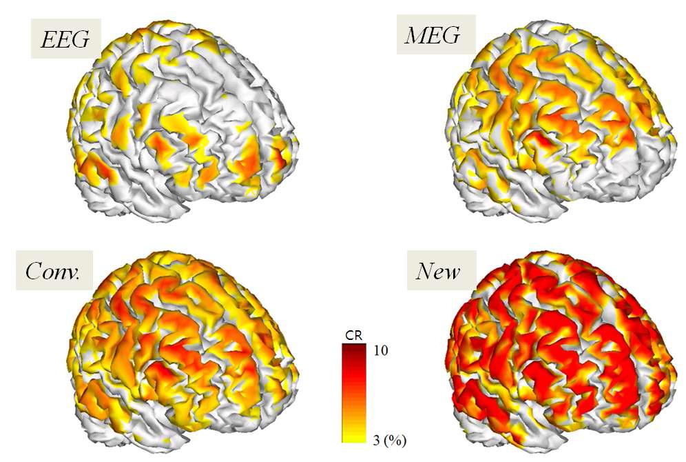 전체 cortical surface 상에서의 CR 값의 분포 - 제안된 방법의 정확도가 월등히 우수함