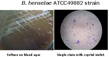 Crystal violet staining of B. henselae cultured on blood agar plate.