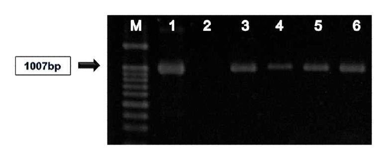 BadA gene PCR-based detection of B. henselae in canine and feline blood samples. Agarose gel (1.5%) demonstrating amplified products from template genomic DNA derived from animal blood is shown. M: DNA size marker (100 bp), lane 1: B. henselae ATCC 49882 (positive control), lane 2: negative control, lane 3, 4: canine positive blood samples, lane 5, 6: feline positive blood samples.