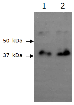 Western blot of BadA using polyclonal BadA antibody. Lane 1: 10 ng of purified recombinant BadA protein, Lane 2: 20 ng of purified recombinant BadA protein.