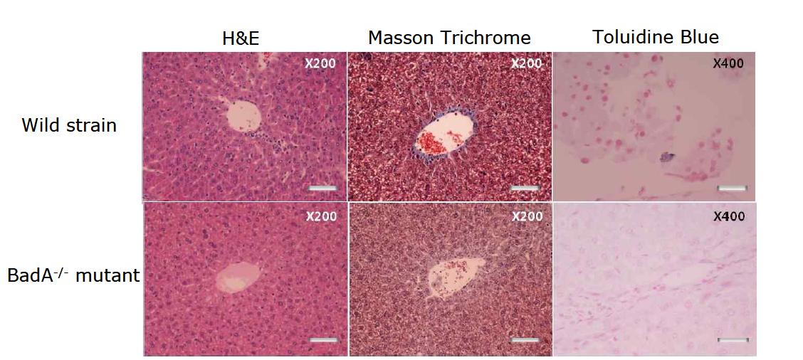 Histological analysis in liver tissue of mice infected with wild strain B. henselae or BadA-/-mutant. Scale bars indicate 5 um (H&E, MT stain) and 10 um (TB stain).