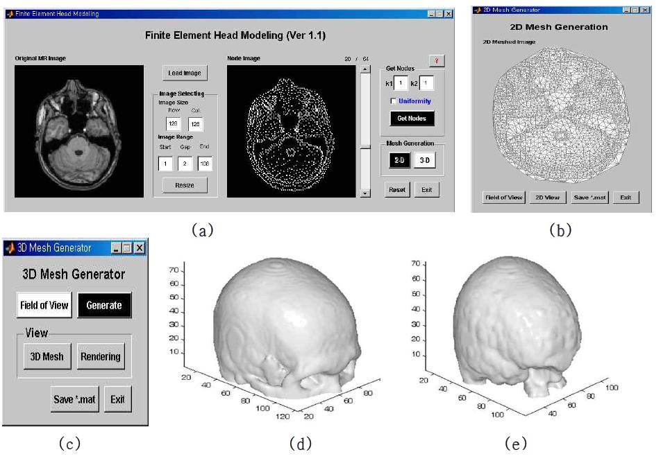 MRI 영상에 기반한 유한요소 머리 모델 생성 기술 예: (a) cMesh 머리e )모델 생성 전체 툴, (b) 2D 모델 생성 툴, (c) 3D 모델 생성 툴, (d),(e) 두개골 지역