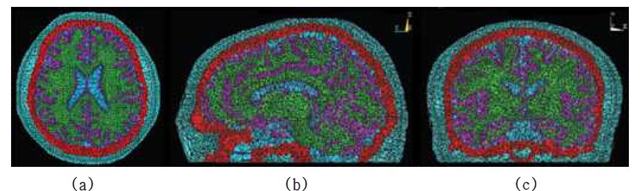 MRI 영상에 기반한 유한요소 머리 모델 : (a) axial 단면, (b) sagittal 단면, (c) coronal 단면