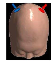 tDCS 가상시스템 2 전극 위치 (붉은색: 양극전극, 푸른색: 음극전극)