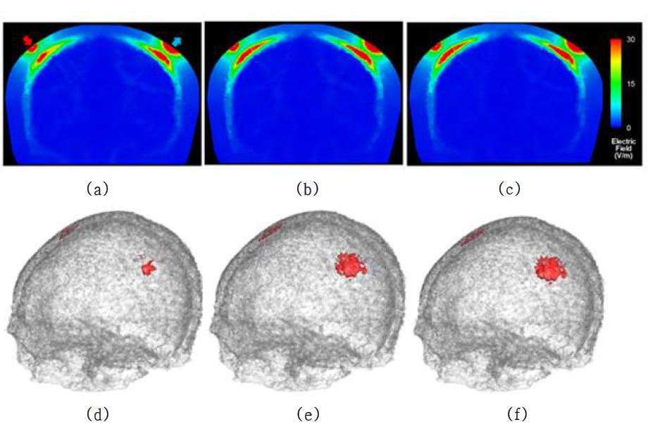 Coronal 단면의 전기장 분포 양상과 (a-c) 두개골 표면의 전기장 분포양상 (d-f): (a), (d) 백질지역 비등방성 비율 10, 두개골 지역 비등방성 비율 1로 고정시킨 모델, (b), (e) 백질 지역 비등방성 비율 10, 두개골 지역 비등방성 비율 2로 고정시킨 모델, (c), (f) 백질 및 두개골의 비등방성 비율 10.