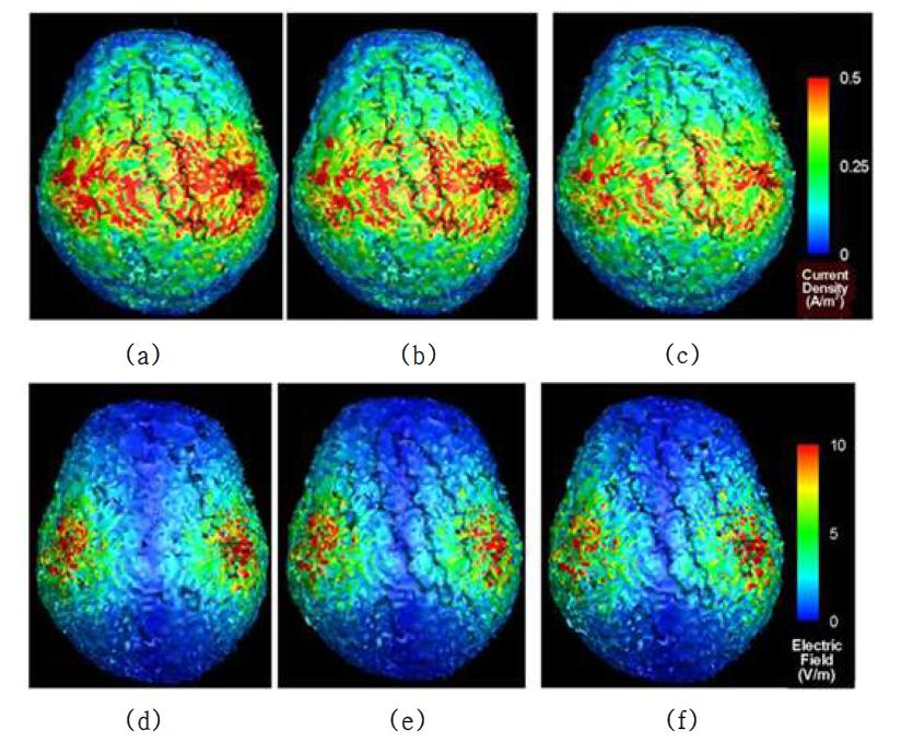 대뇌 피질 표면의 전류밀도 분포 양상과 (a-c) 전기장 분포 양상 (d-f): (a), (d) 백질 지역 비등방성 비율 10, 두개골 지역 비등방성 비율 1로 고정시킨 모델, (b), (e) 백질 지역 비등방성 비율 10, 두개골 지역 비등방성 비율 2로 고정시킨 모델, (c), (f) 백질 지역 비등방성 비율 10, 두개골 지역 비등방성 비율 10으로 고정시킨 모델