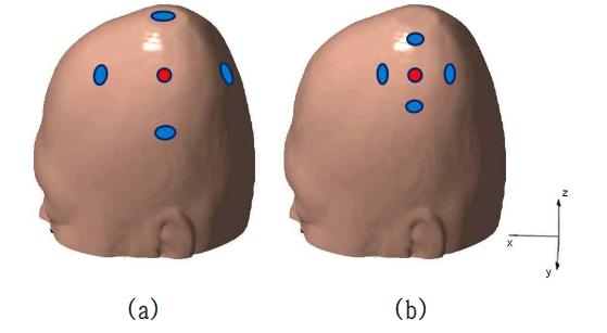 4+1 원형전극 중 양극과 음극의 거리 분포 차이에 따른 2가지 모델 : (a) 모델 1, (b) 모델 2