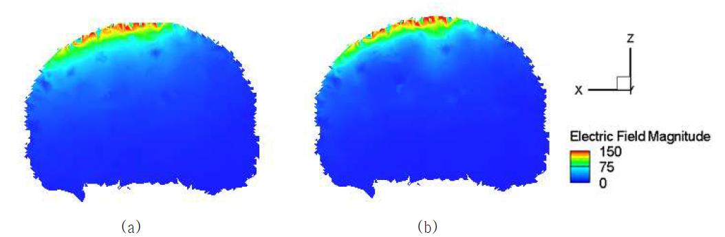 FOE 코일에 의해 자극된 (a) 등방성 모델과 (b) 비등방성 모델의 뇌 단면 유도전기장 세기 및 분포 양상