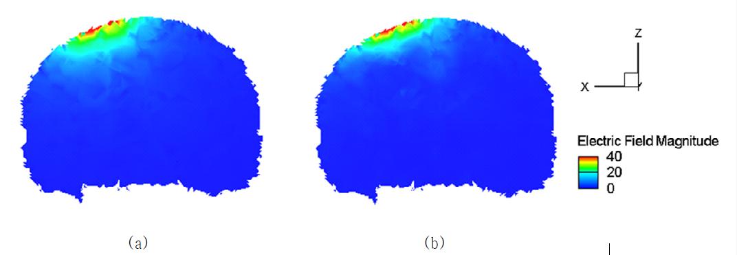 차폐판을 적용 시킨 FOE 코일에 의해 자극된 (a) 등방성 모델과 (b) 비등방성 모델의 뇌 단면 유도전기장 세기 및 분포 양상
