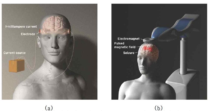 (a) 경두개 직접 전류 자극기 (tDCS), (b) 경두개 자기 자극기 (TMS)