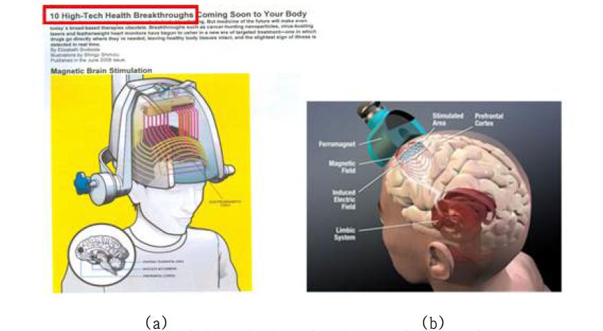 (a) Popular Mechanics에 미래 10대 의료 시스템 중에 하나로b) 등재, (b) FDA Clearance를 획득한 NeuroStar사의 TMS