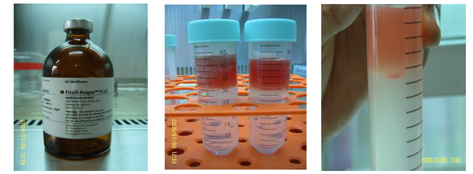 사용시약 및 진행 과정; Ficoll-paque, Overlay 및 Centrifugation