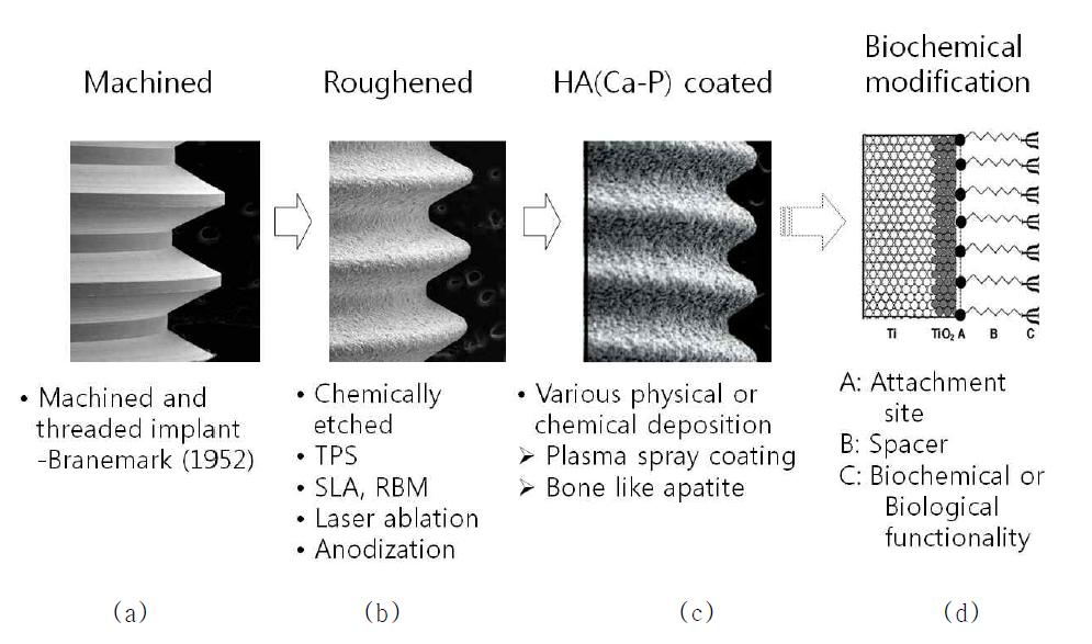 티타늄 임플란트의 표면개질 방법과 발전 방향