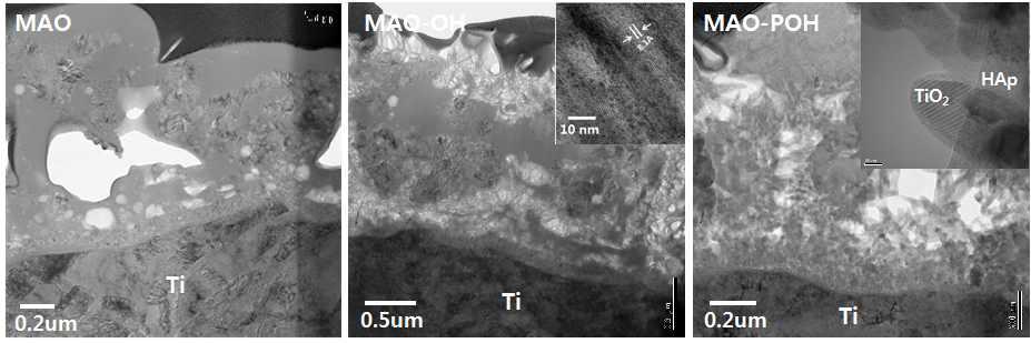 MAO 처리된 시편((a)과 OH 열수처리(b) 및 POH 열수처리(c)된 시편들의 투과전자현미경 사진. 삽입된 그림은 고분해능 TEM 사진