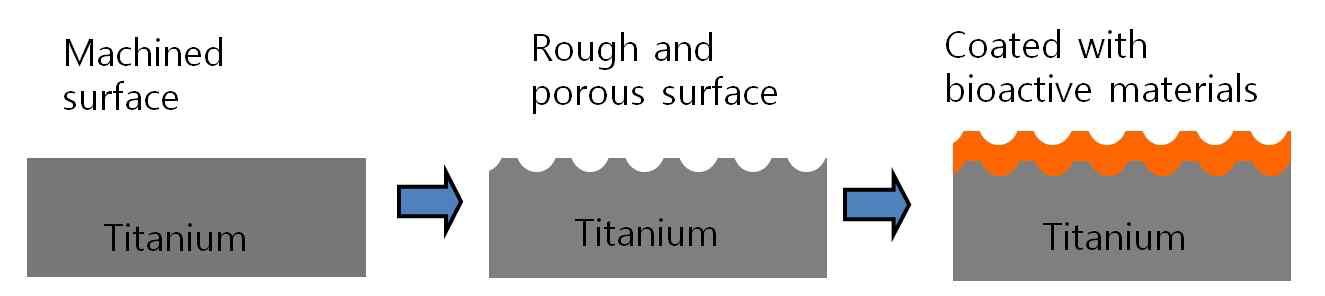 티타늄 임플란트 생체활성도를 증가시키기 위한 방법의 발전 과정
