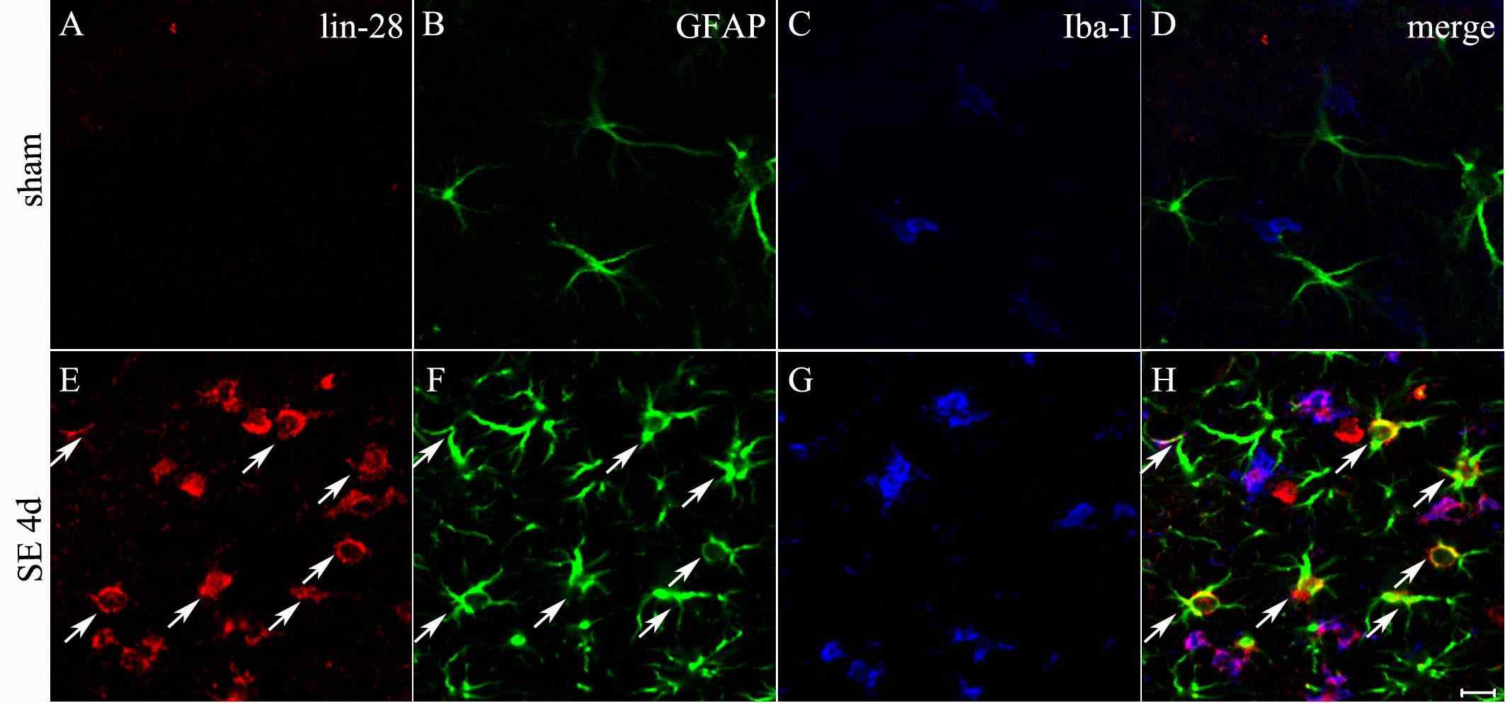 필로카르핀으로 유도한 경련중첩 후 lin-28 RNA 발현 세포의 종류 규명. sham에서는 lin-28 RNA와 이중표지되는 세포는 관찰할 수 없었음(A-D). 경련중첩 4일째, lin-28 RNA는 GFAP로 표지되는 별아교세포에서도 관찰되고(E, F, H), Iba-I으로 표지되는 미세아교세포에서도 발현됨을 관찰함(E, G, H). 화살표는 lin-28 RNA를 발현하는 별아교세포를 나타냄. scale bar in H = 10 um.