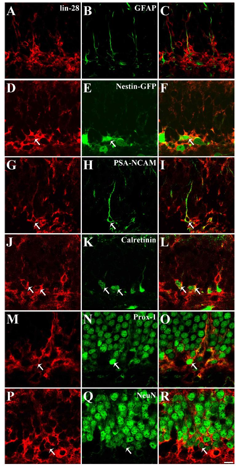 필로카르핀으로 유도한 경련중첩 후 3일 째 치아이랑에서의 lin-28 발현 세포의 종류 규명. lin-28 면역염색성은 GFAP를 발현하는 줄기세포 또는 별아교세포에서는 나타나지 않았으나 (A-C), type II 세포의 표지자인 nestin과는 일치하였음(D-F). 신경 기원세포의 표지자인 PSA-NCAM, 미성숙 및 성숙 신경세포의 표지자인 prox-1, NeuN과는 매우 드물게 일치하였고(G-I,M-R). 미성숙 신경세포의 표지자인 calretinin의 경우, lin-28은 다른 표지자들에 비해 비교적 많은 세포들에서 발현되었음(J-L). scale barin O = 10 um.