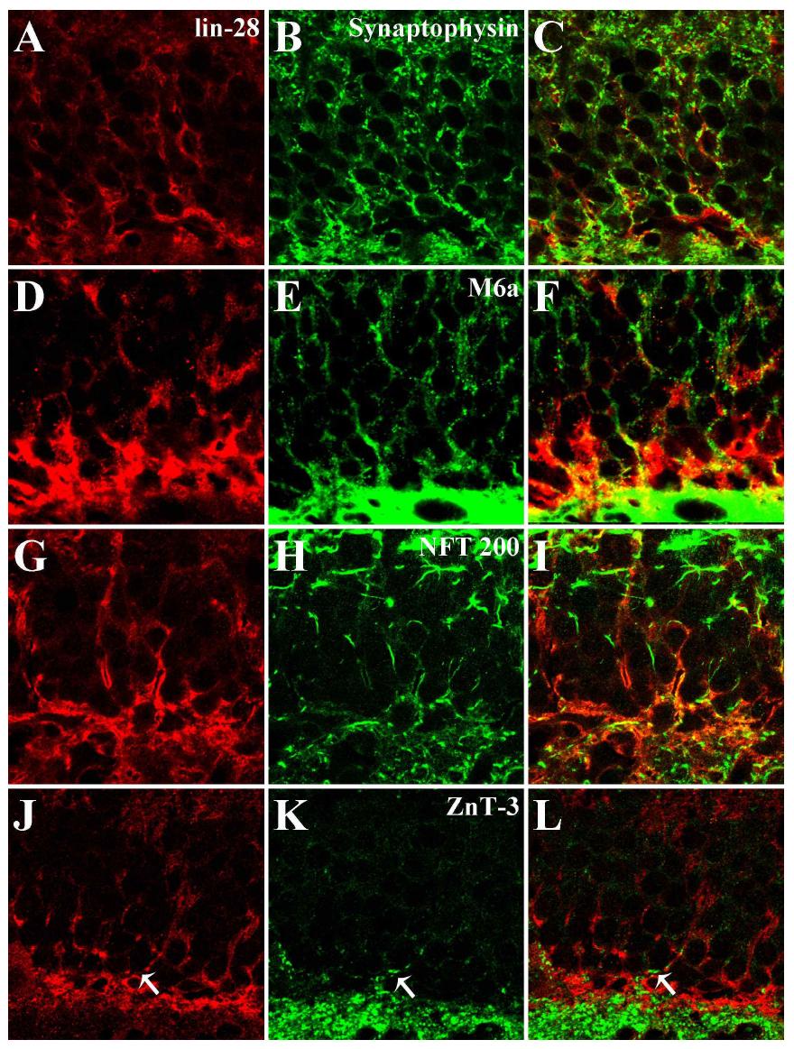 필로카르핀으로 유도한 경련중첩 후 3일 째 치아이랑에서의 lin-28 발현 세포의 특성 규명. lin-28 면역염색성은 축삭의 표지자인 synaptophysin과 대부분 일치하였으며(A-C), glutamatergic axon의 표지자인 M6a (D-F)와 신경섬유의 표지자인 NFT200 (G-I), 이끼섬유의 표지자인 ZnT-3 (J-L)와 상당부분 일치하였음. scale bar in O = 10 um.