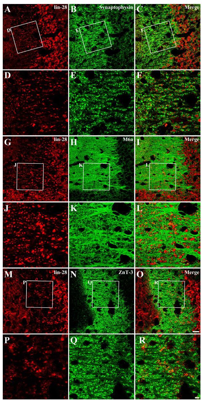 필로카르핀으로 유도한 경련중첩 후 3일 째 CA3 영역에서의 lin-28 발현 세포의 특성 규명. lin-28 면역염색성은 축삭의 표지자인 synaptophysin과 일치하였으며(A-F), glutamatergic axon의 표지자인 M6a (G-L)와 이끼섬유의 표지자인 ZnT-3 (M-R)와도 상당부분 일치하였음. scale bar in O = 10 um.