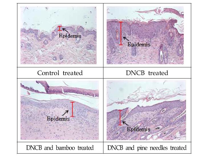 Histologic features of skin lesion in NC/Nga mice