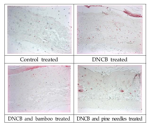 Change of Mast cell in mice skin treated with DNCB, DNCB+Bamboo extracts, DNCB+Pine needles extracts