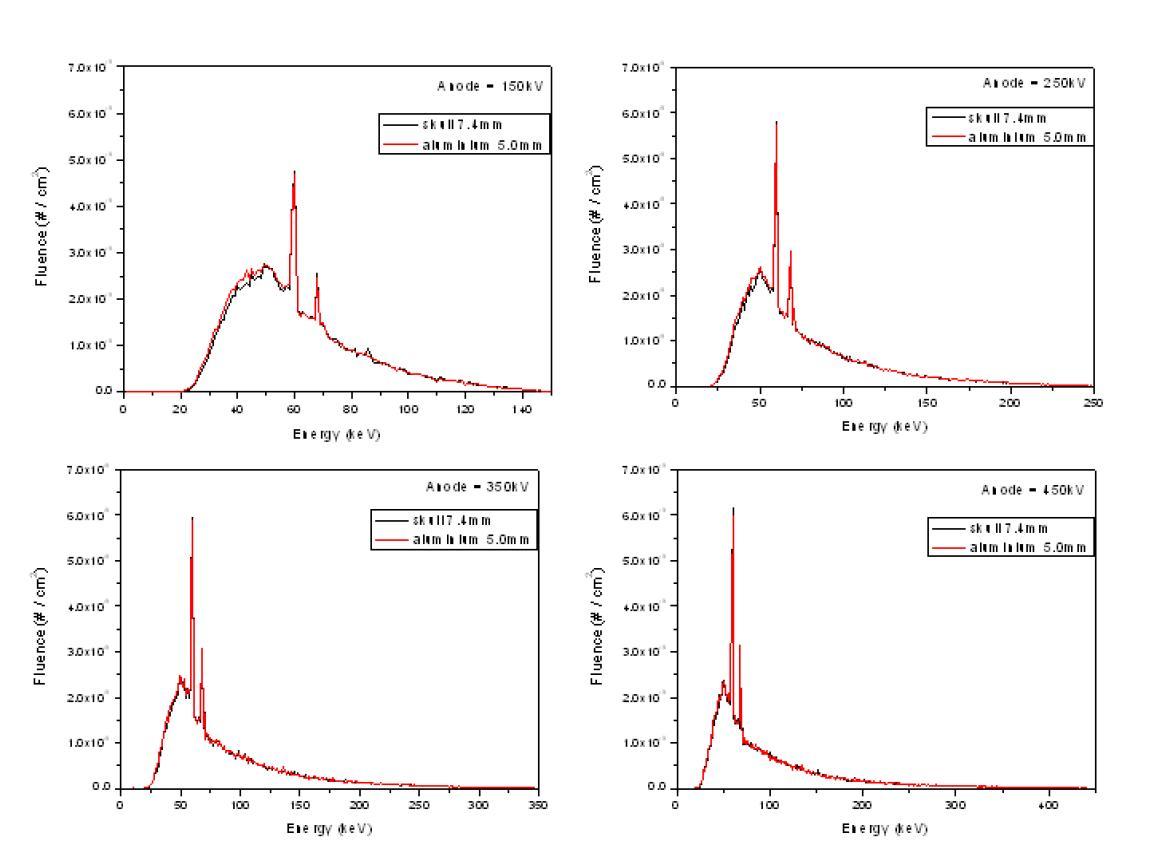 150, 250, 350, 450kV x-ray spectrum source 사용시 phantom 내에서 측정되는 energy spectrum 비교. (남성의 skull 두께 7.4mm 기준).