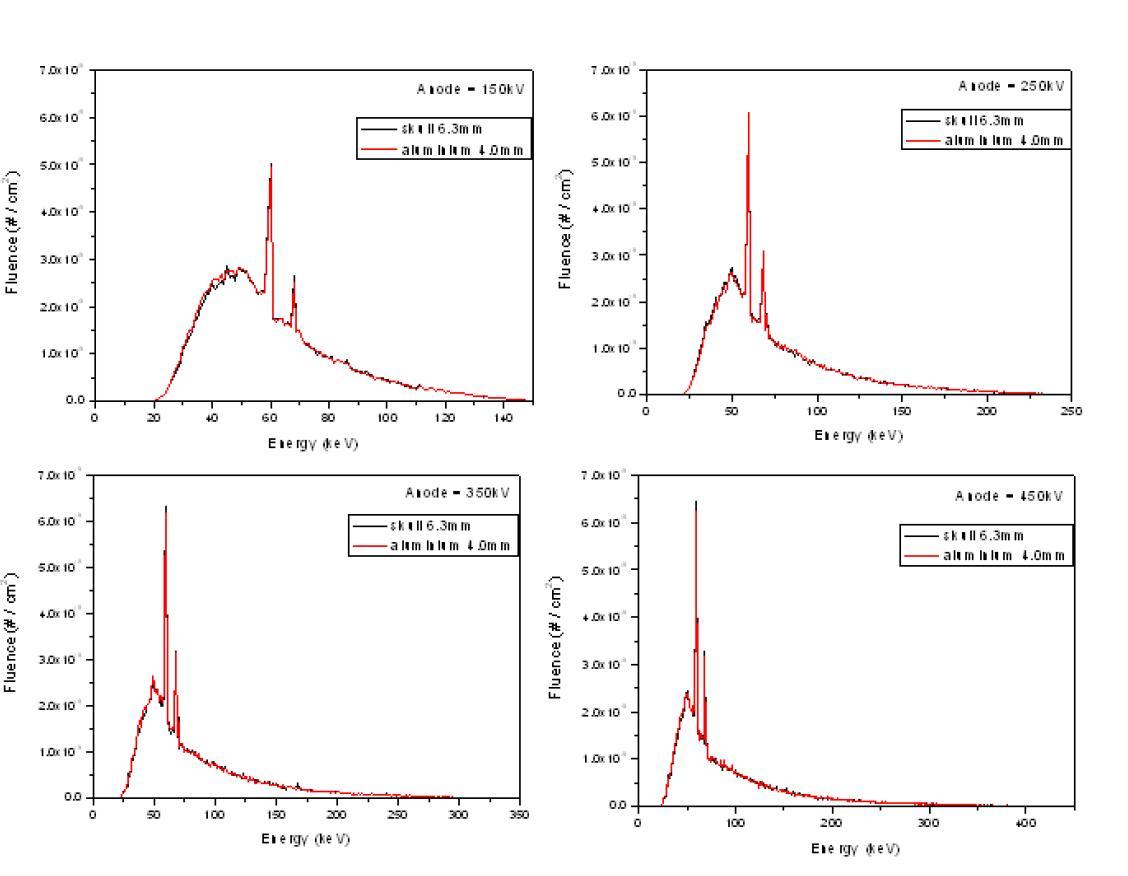 150, 250, 350, 450kV x-ray spectrum source 사용시 phantom 내에서 측정되는 energy spectrum 비교. (여성의 skull 두께 6.3mm 기준).