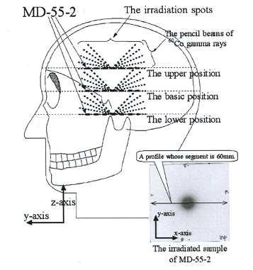 standard japanese man's head phantom을 이용한 MD-55-2 film dosimetry 도식.