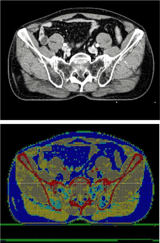 Converted DICOM file to JPG image (upper) and converted DICOM file to geant4 format with openGL (lower)