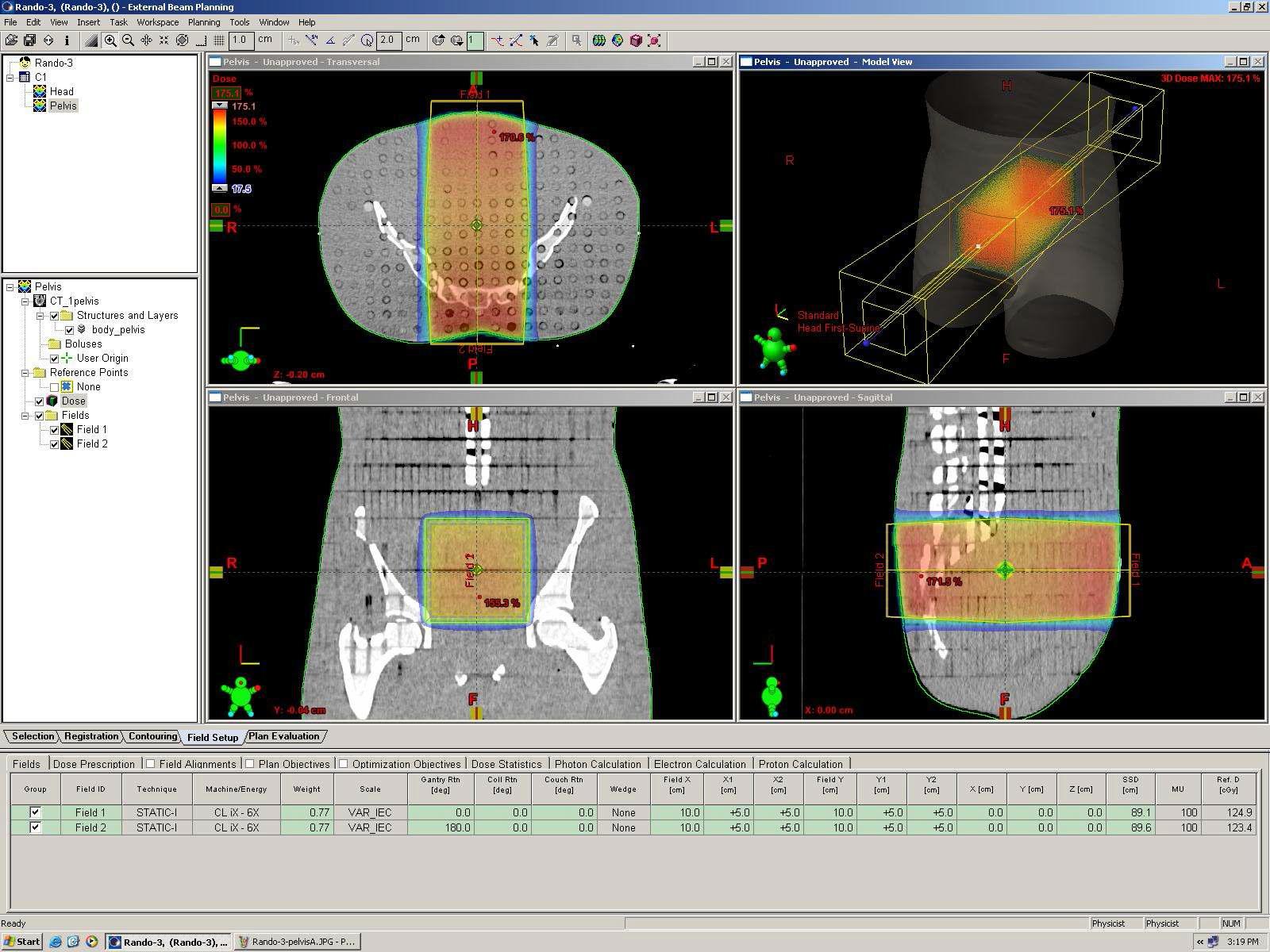 treatment plan program of varian model's accelerator