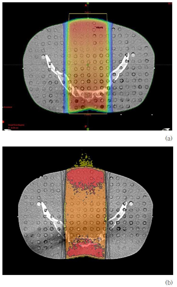 The planned dose distribution(a) and simulated dose distribution(b) of pelvis in 6 MV photon beam