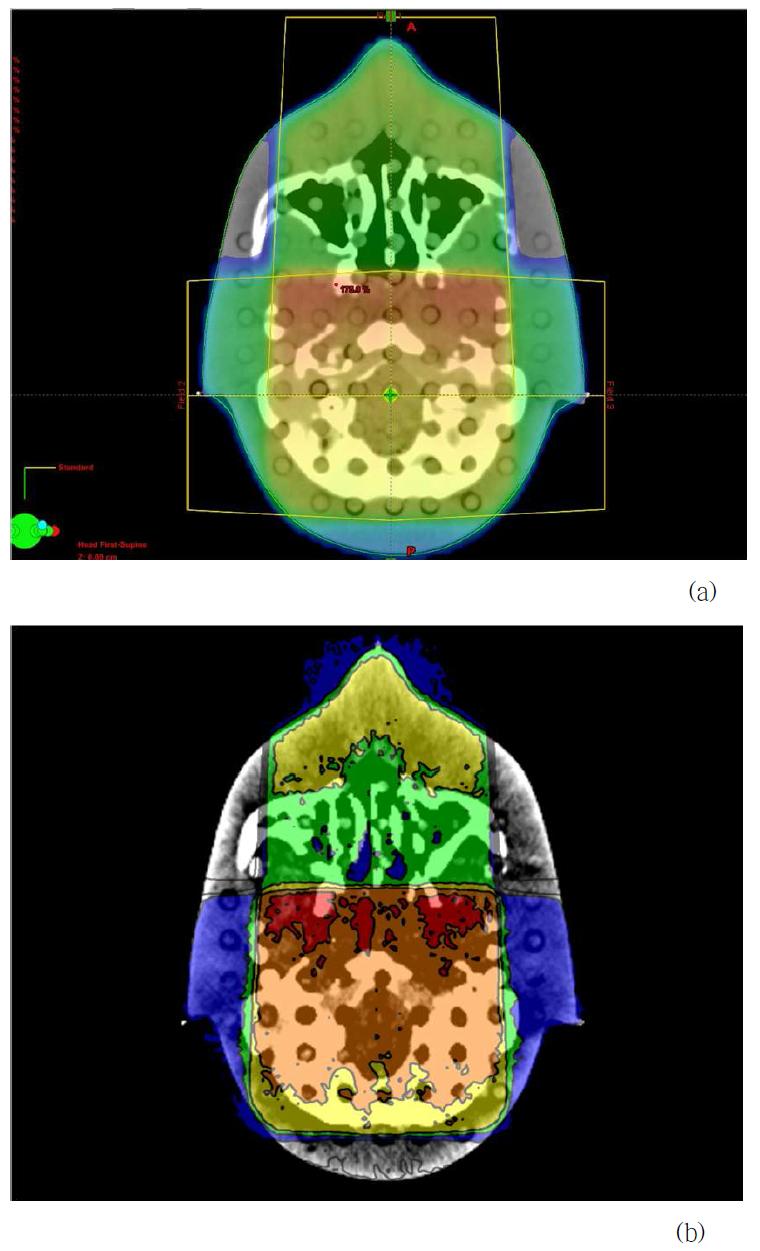 The planned dose distribution(a) and simulated dose distribution(b) of pelvis in 6 MV photon beam