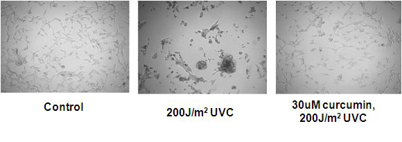 5-LOX 저해제인 curcumin에 의한 UV-특이적 세포 사멸 저해 효과