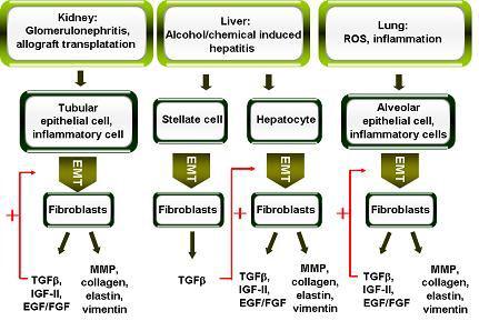 EMT 신호 교란과 섬유화증의 진행