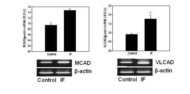 Effects of IF on mRNA expression of genes involved in mitochondrial fatty acid β-oxidation in NMu2Li liver cells.