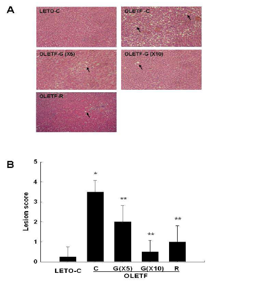 Inhibition of hepatic lipid accumulation by GGEx in genetically obese OLETF rats.